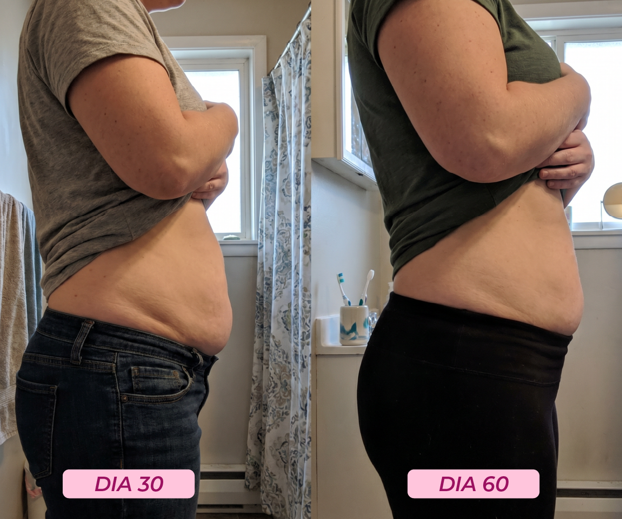 Testimonio — evolución día 30 a día 60 con Aurea Prestige