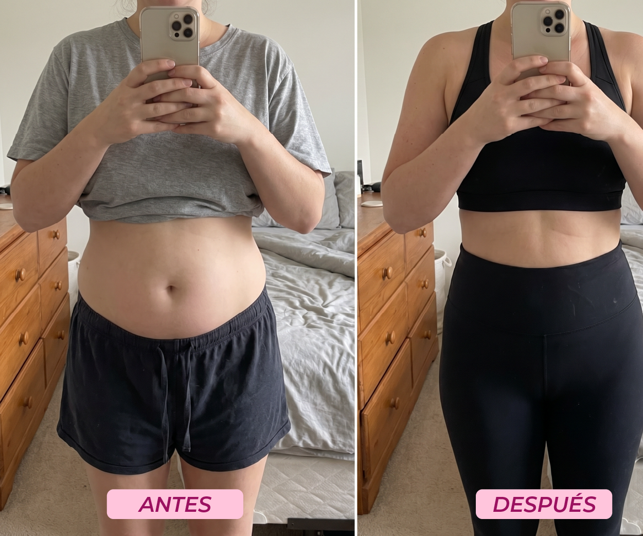 Testimonio — evolución antes y después con Aurea Prestige